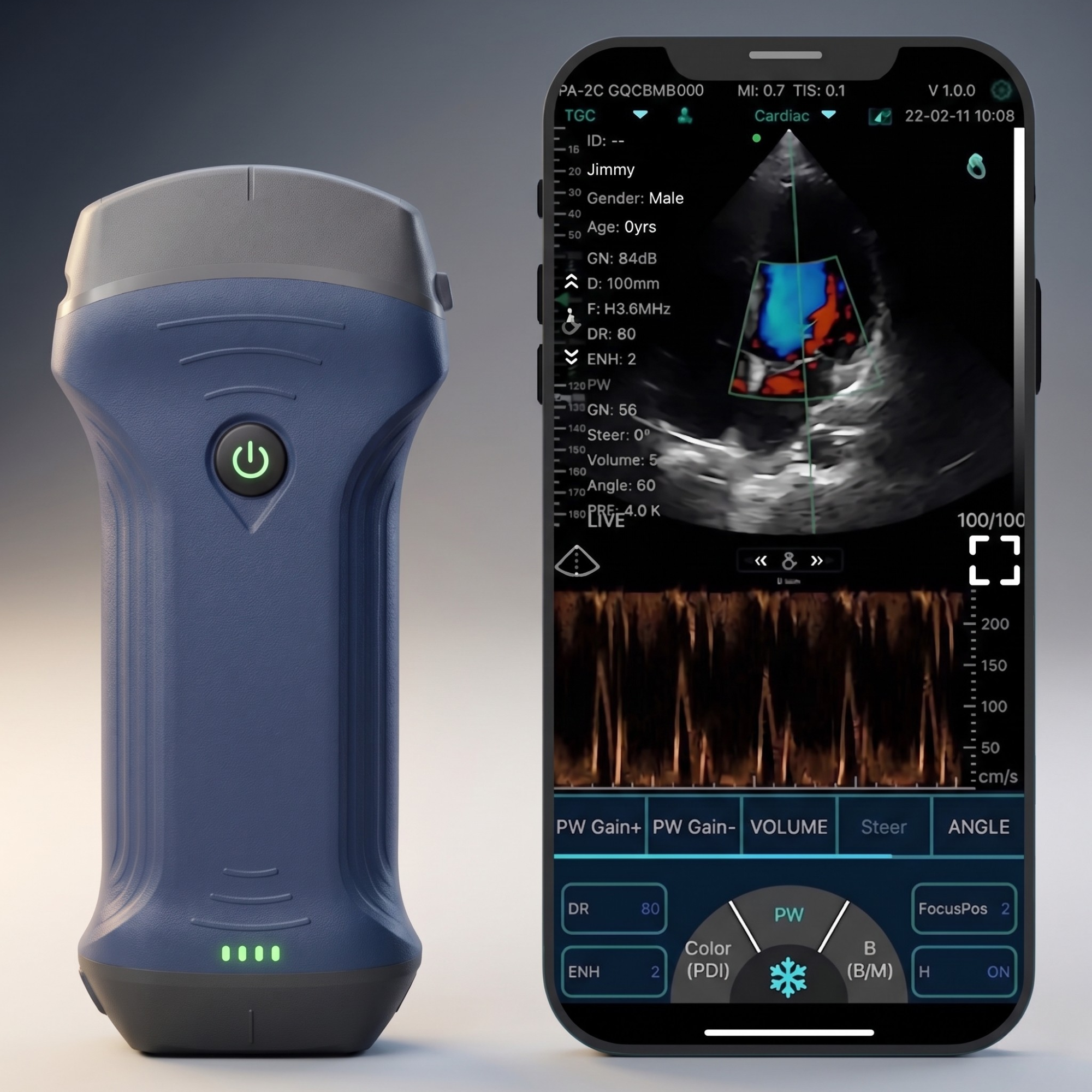 Ultrassom Konted Pro 3x1 sem fio e com cabeça dupla (com ANVISA)